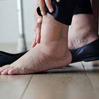 medical hosiery can treat leg swelling