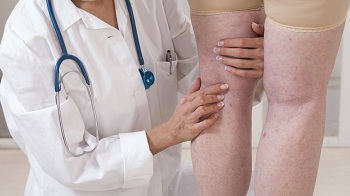 doctor treating swollen legs