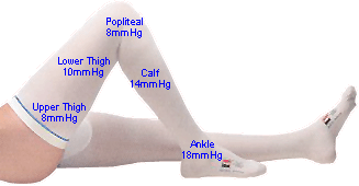 picture of medical compression socks measurement for patients