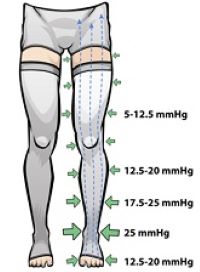 Image showing the distribution of the compression ratio along the length of a leg pressure gear