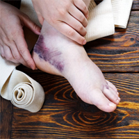 foot trauma with blood clotting