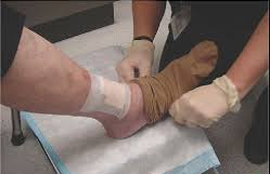 A nurse helping a patient with a leg wound wear pressure socks