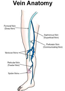 how varicose veins look like