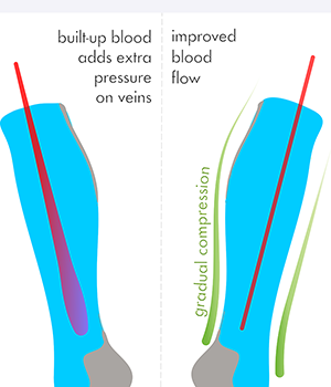 how light knee high compression socks work